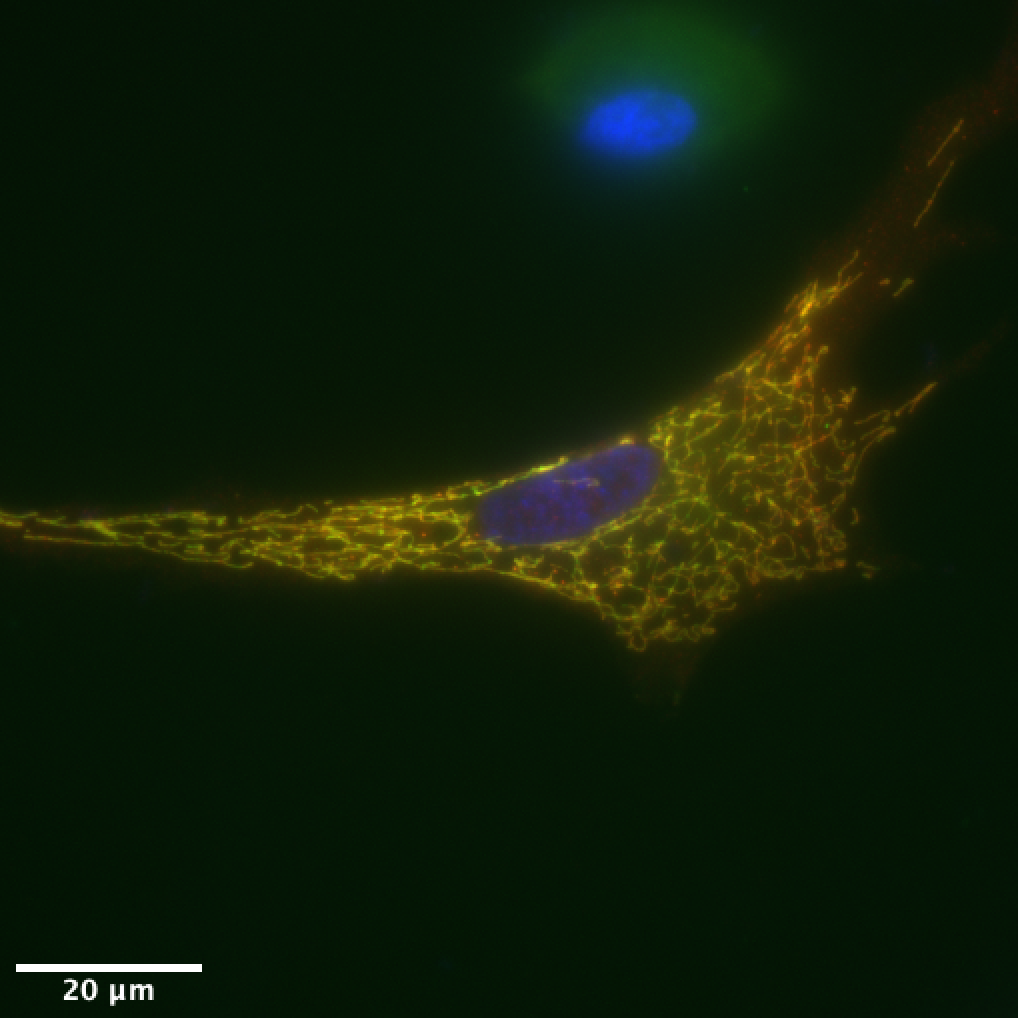 An image of  chicken cell expressing a Marek disease virus protein by Sareeta Bagri