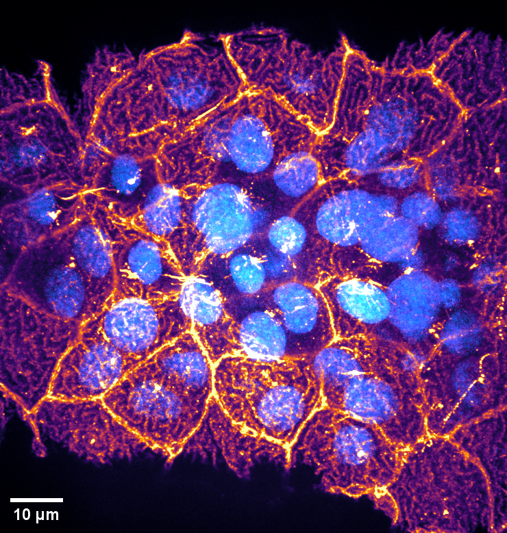 An image of skin cells by Sunandan Dhar