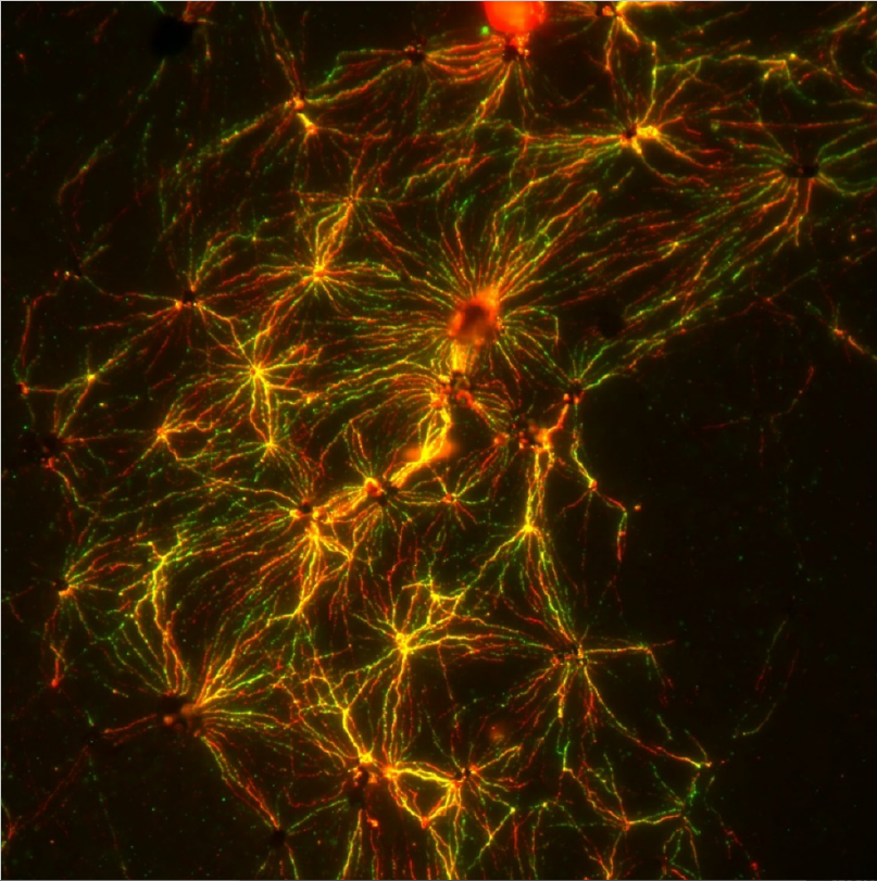 An image of DNA strands by Tsz Wai (Bernice) Chan 