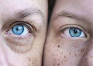Two people's faces next to each other, zoomed in on their blue eyes.